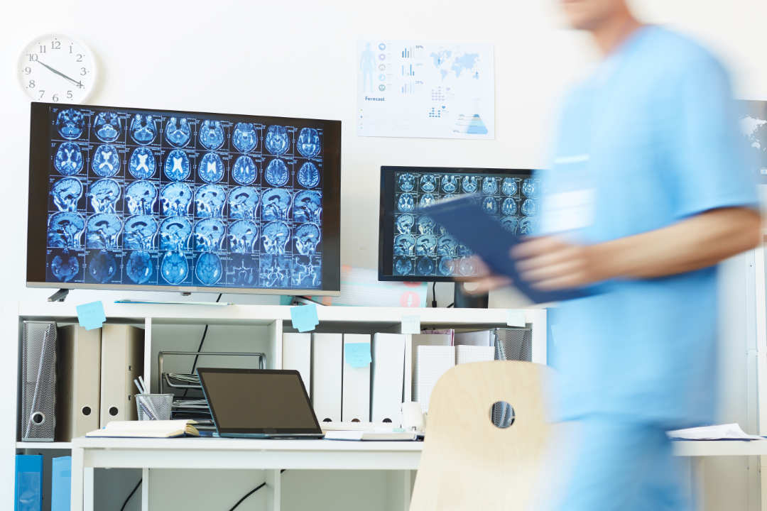 Brain Computer Tomography Images